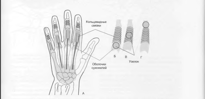 Механізм розвитку кісткових наростів на суглобах пальців рук при артрозі: вузлики Гебердена і Бушара прослизають під кільцеподібним зв'язками і не можуть повернутися назад. В результаті блокується розгинання фалангових суглобів.
